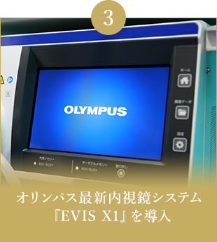 オリンパス最新内視鏡システム『EVIS X1』を導入