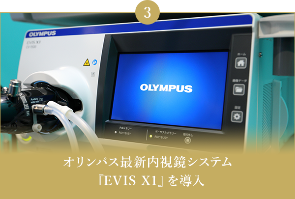 オリンパス最新内視鏡システム『EVIS X1』を導入