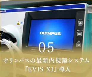05オリンパスの最新内視鏡システム『EVIS X1』導入