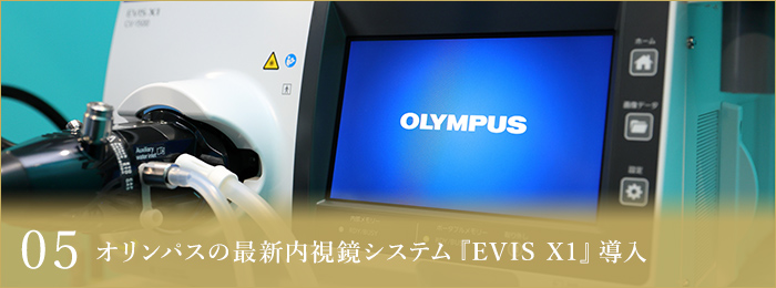 05オリンパスの最新内視鏡システム『EVIS X1』導入